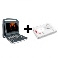 Pacchetto risparmio: Ecografo Chison ECO 2 con sonda lineare da 10 Mhz+ dispositivo per elettrolisi percutanea terapeutica APS e4 Pacchetto risparmio: Ecografo Chison ECO 2 con sonda lineare da 10 Mhz+ dispositivo per elettrolisi percutanea terapeutica APS e4